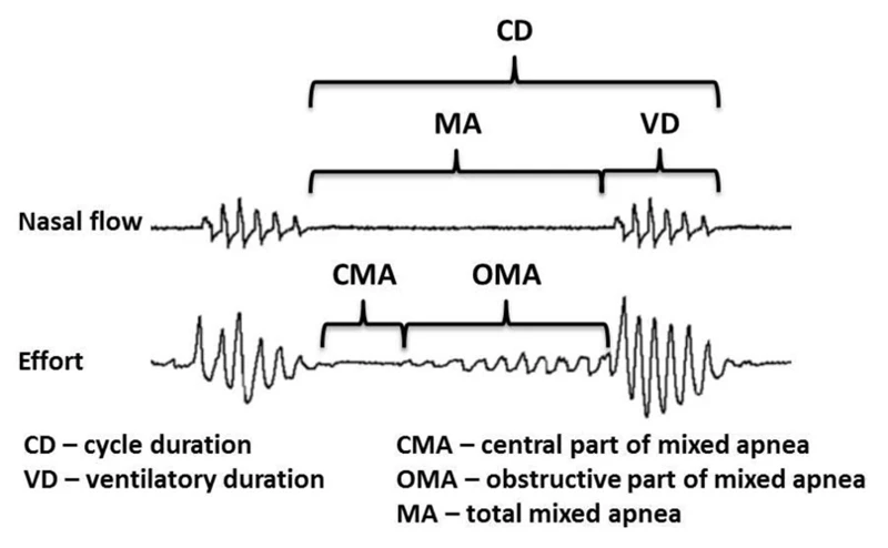 Central Sleep Apnea