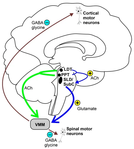 Complications Of Untreated Rem Sleep Behavior Disorder