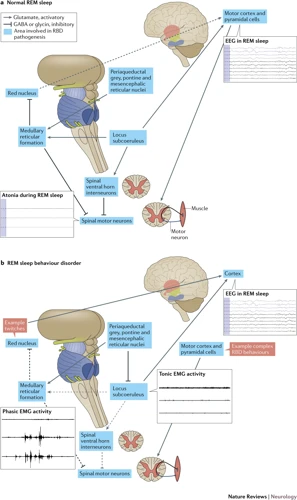 Diagnosing Rem Sleep Disorder