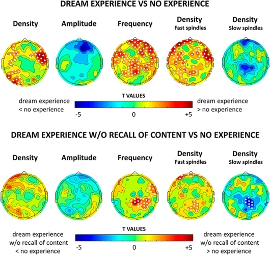 Dreaming During Rem Sleep