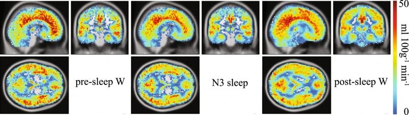 How To Improve Non-Rem Sleep