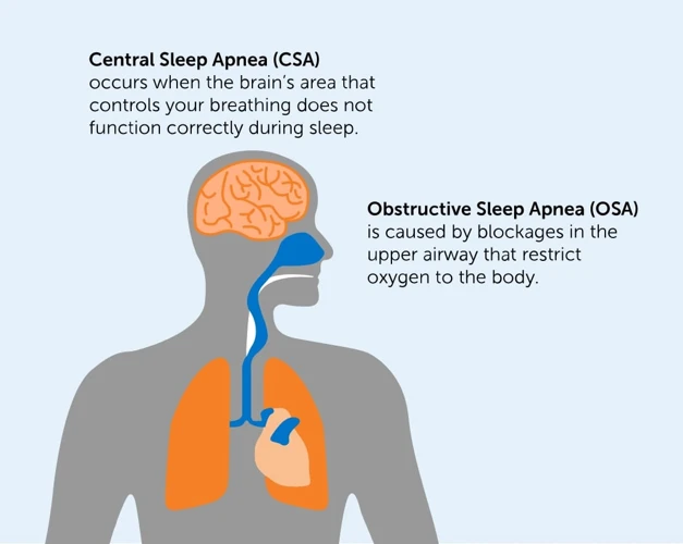 Types of Sleep Apnea: Obstructive vs Central