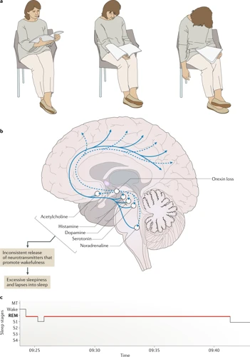 Sleep And Narcolepsy