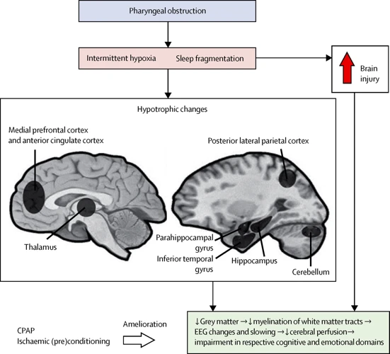 Sleep Apnea And Brain Health