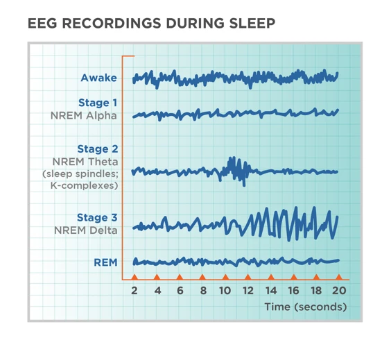 The Brain Waves During Non-Rem Sleep